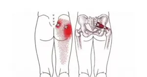 Top 10 Exercises For Piriformis Syndrome To Help You Get Rid Of Your Pain – Piriformis Stretches To Remove Hip And Lower Back Pain